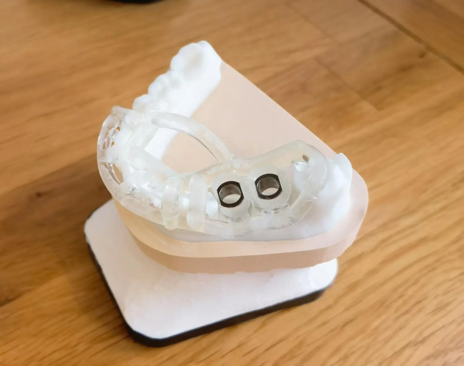 Implantatversorgungen